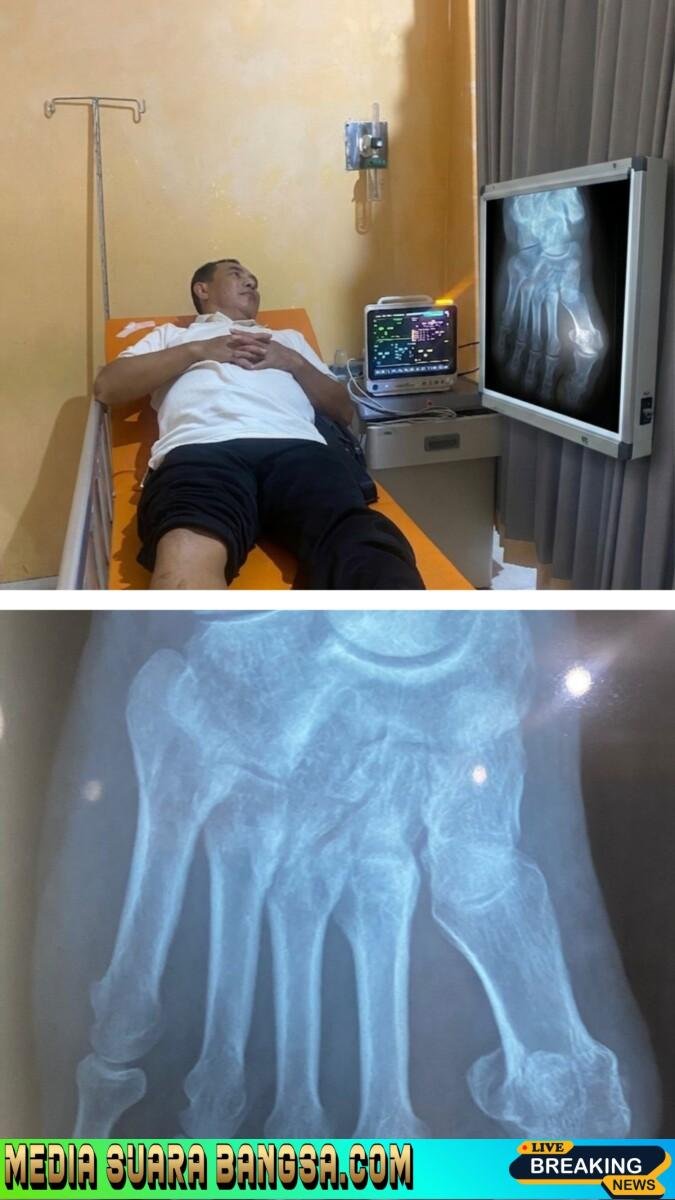 Hasil Rontgen SHN Patah Tulang, Direktur PT. BIY Terancam Pasal Penganiayaan Berat